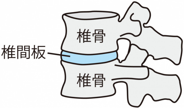 頚椎椎間板イラスト