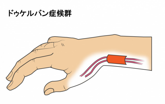 手のイラスト