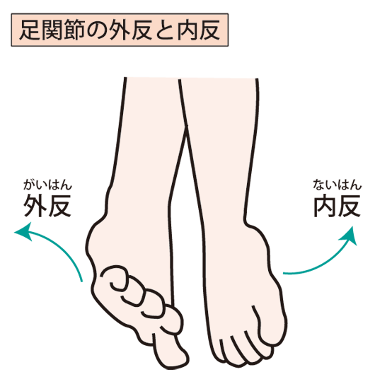 捻挫の画像